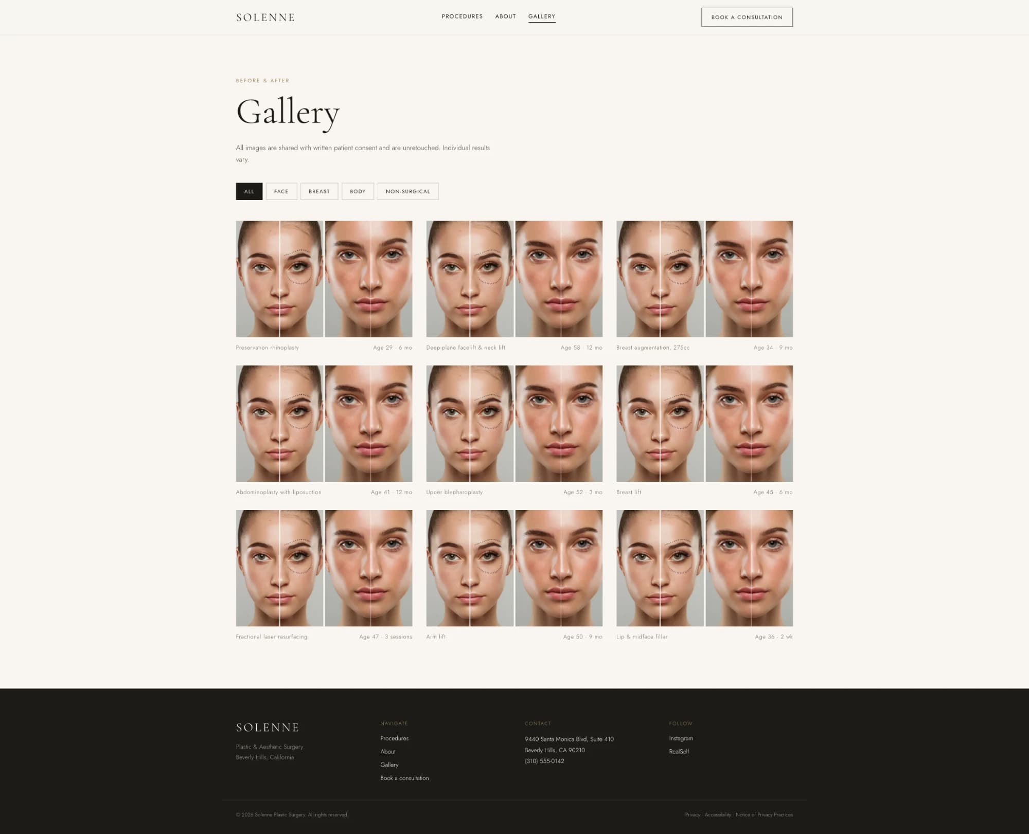 Solenne template gallery page — before and after pairs with category filters